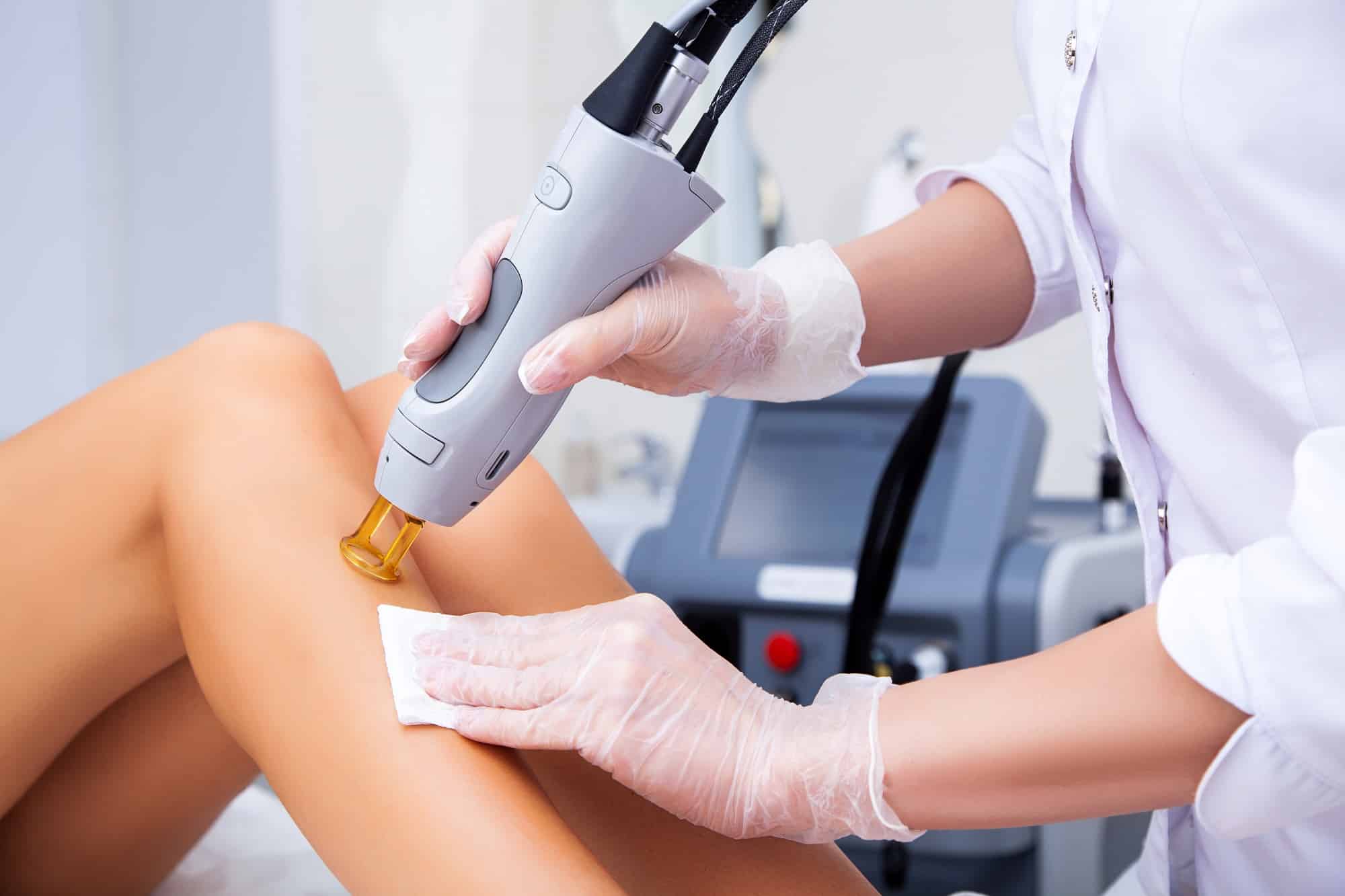 Laser Hair Removal Services in Santee CA